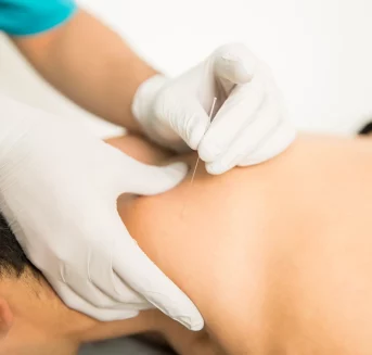 Dry Needling | concierge health and wellness |Montana|